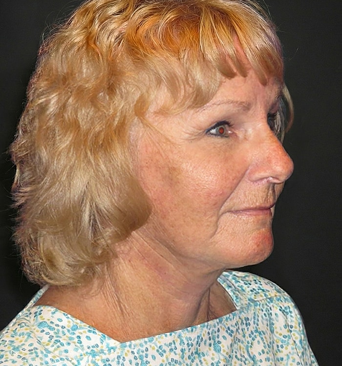 Woman with short, curly blonde hair profile.
